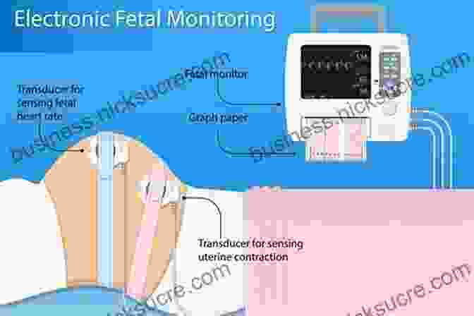 Advanced Fetal Monitoring Techniques Like EFM And Doppler Ultrasound Ensuring Safe Birth. Taking Charge Of Your Pregnancy: The New Science For A Safe Birth And A Healthy Baby