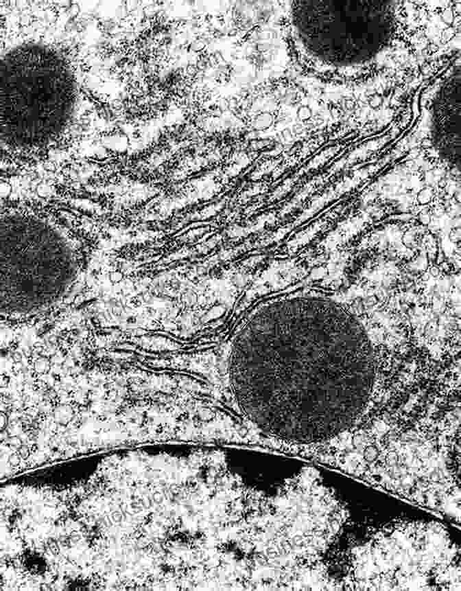 Transmission Electron Micrograph Of A Cell Anatomy Histology Cell Biology: PreTest Self Assessment Review Fourth Edition